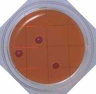 Desoxycholate Agar - Food Stamp